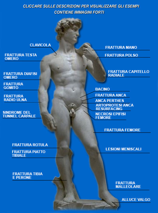 Roberto Sciortino